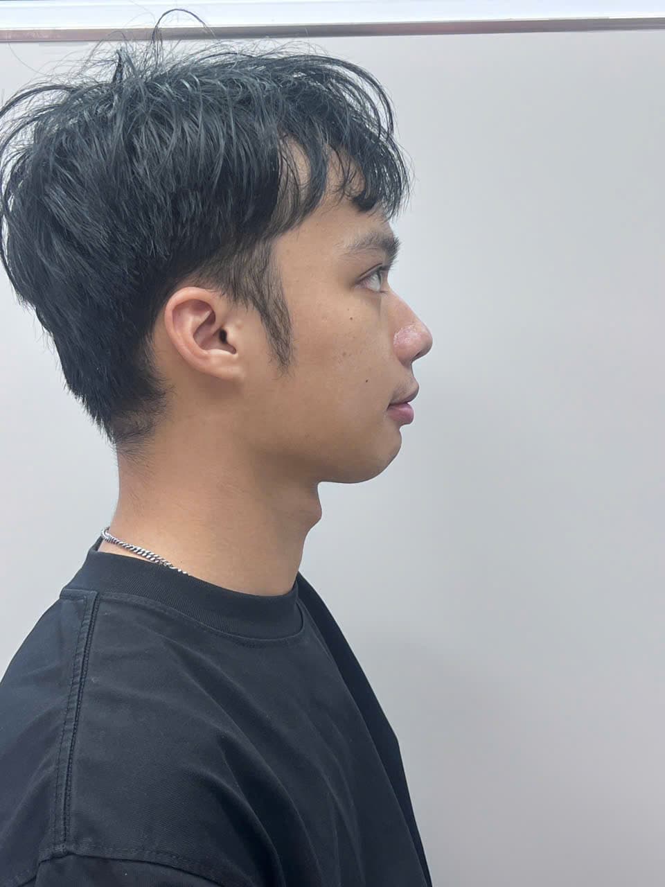 Nguyễn Thanh Khải - Trước điều trị